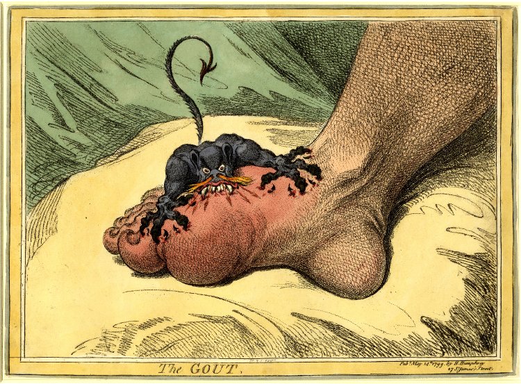 The Gout, James Gillray, 1799